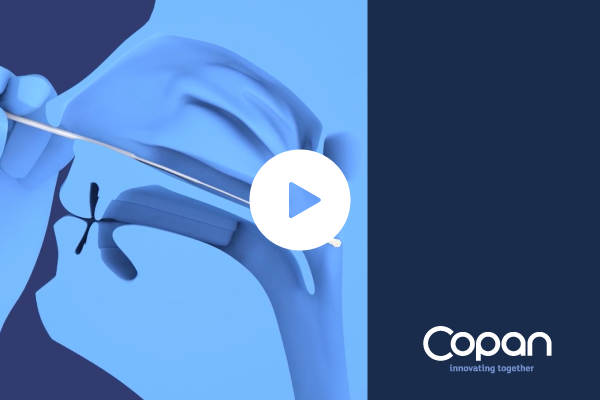 Superior Performance